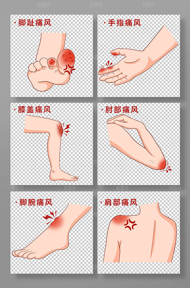 创意卡通痛风医疗手绘元素插画