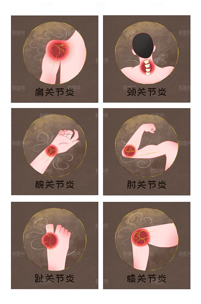 传统复古关节炎部位医疗元素插画