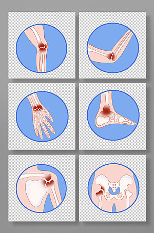蓝色简约骨头关节炎医疗元素组合插画