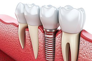 牙齿立体医学模型