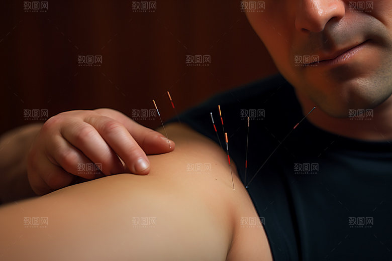 中医针灸健康点穴摄影图