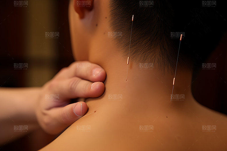 中医针灸点穴传统文化摄影图