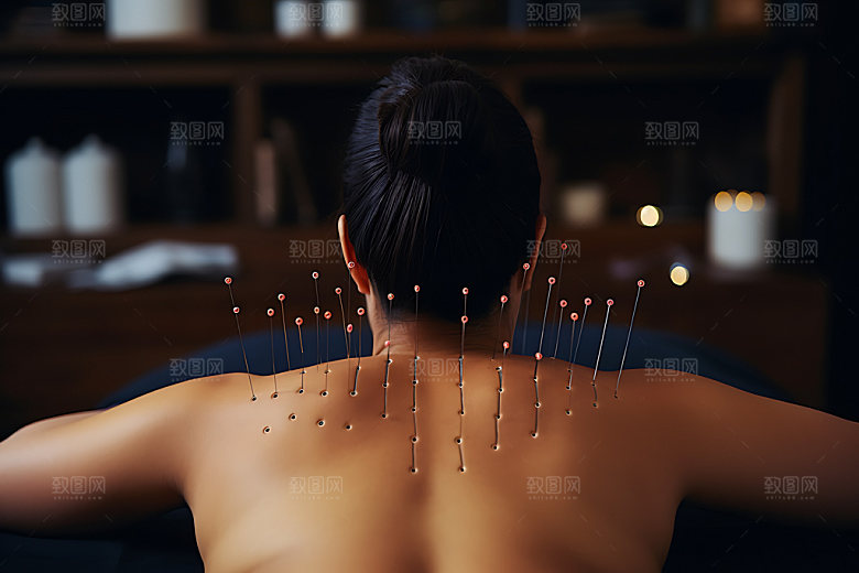 中医针灸治疗点穴摄影图
