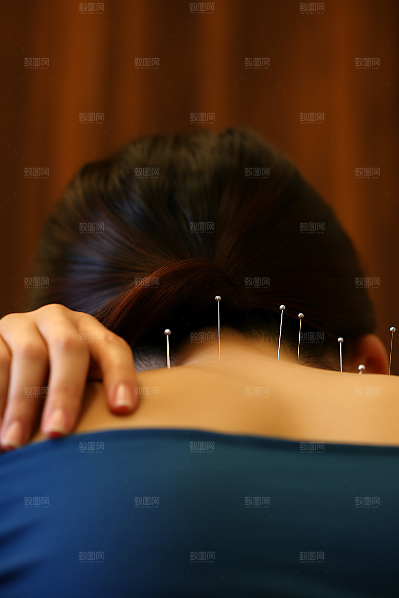中医针灸点穴健康摄影图