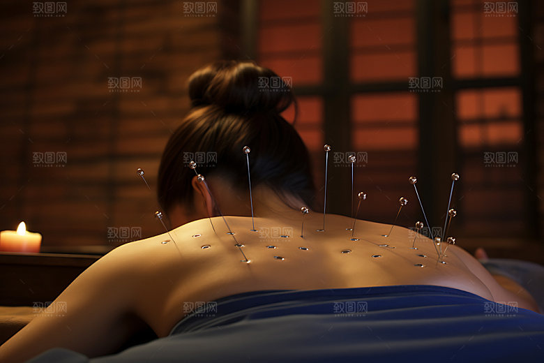 中医针灸传统文化健康摄影图