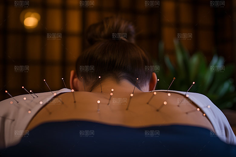 中医针灸治疗传统文化摄影图