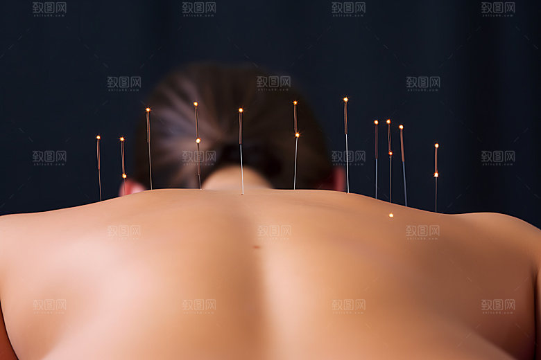中医针灸点穴传统文化摄影图