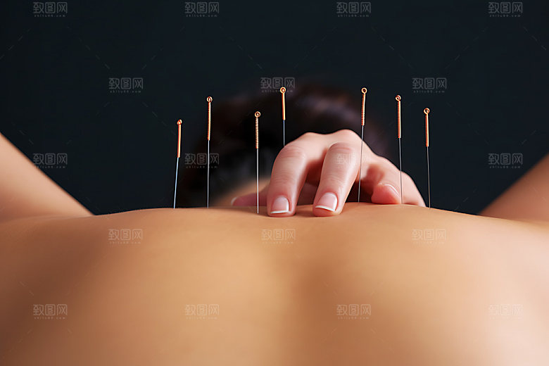 中医针灸传统文化健康摄影图