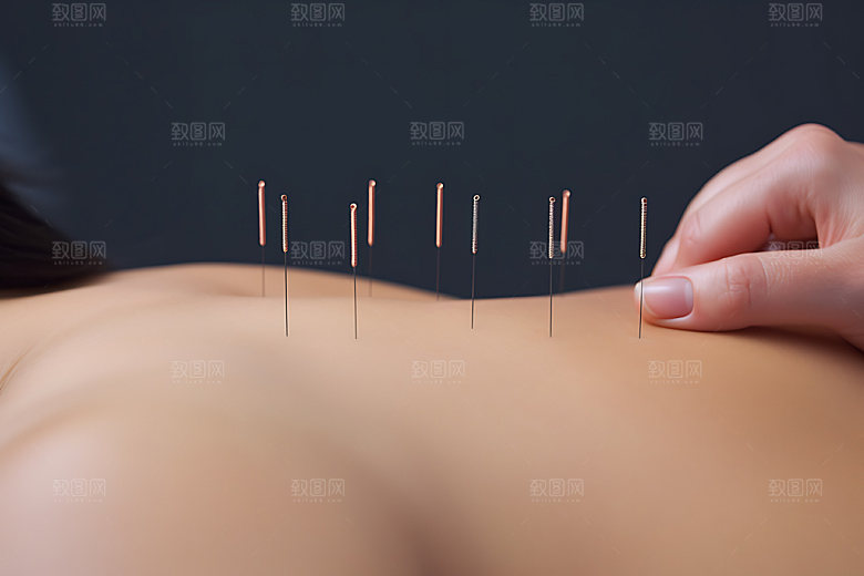 中医针灸点穴穴位针灸摄影图