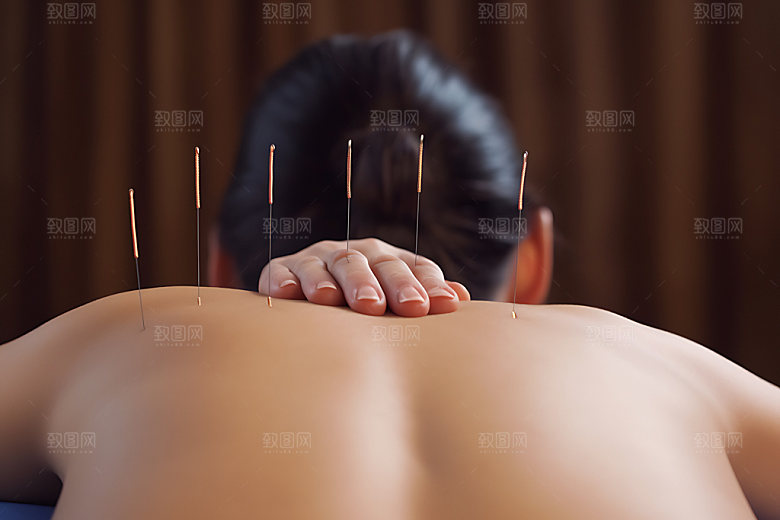 中医针灸医疗传统文化摄影图