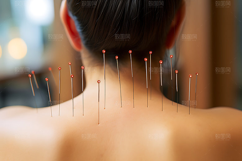中医针灸医疗传统文化摄影图