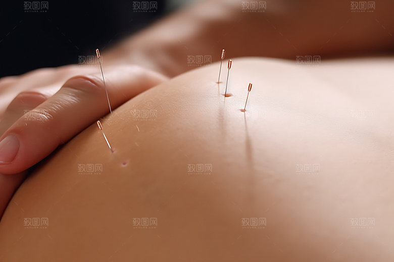 中医针灸点穴传统文化摄影图
